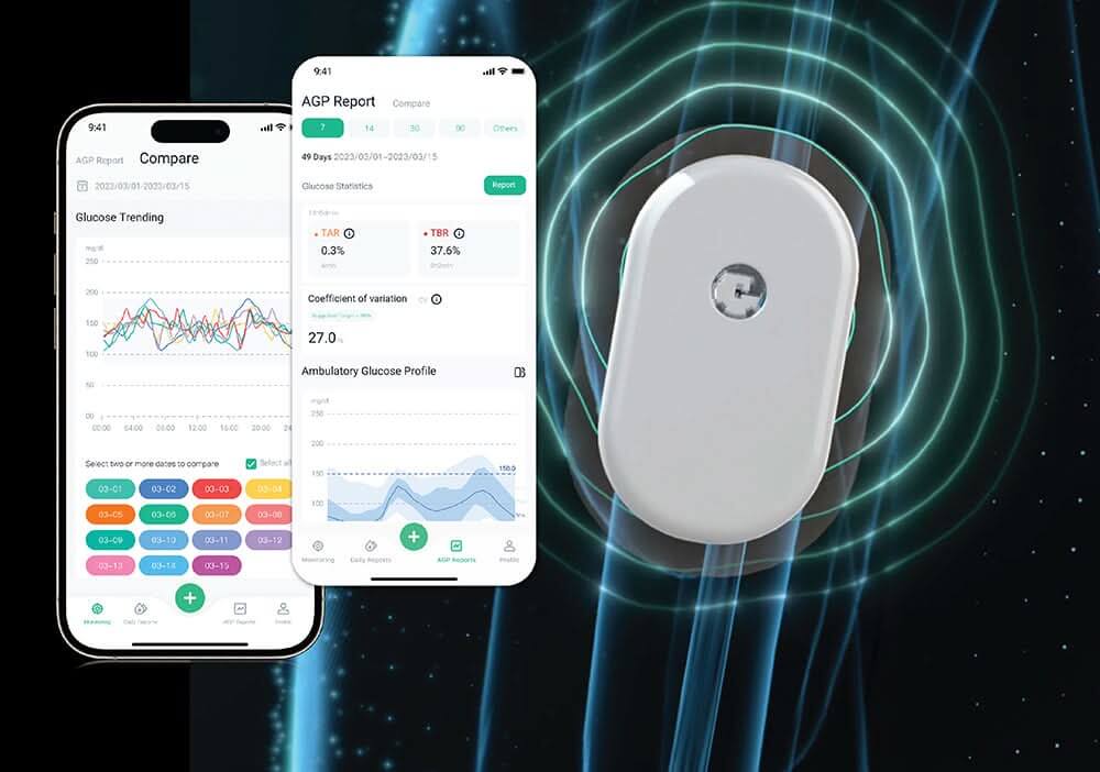 SIBIONICS GS1 CGM – Image 2
